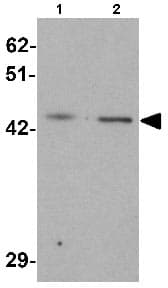 Lmx1b Antibody Ab139736  Western Blot Img17145