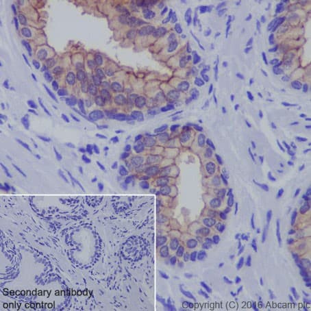 Anti-Claudin 3 antibody [EPR19971](AB214487)