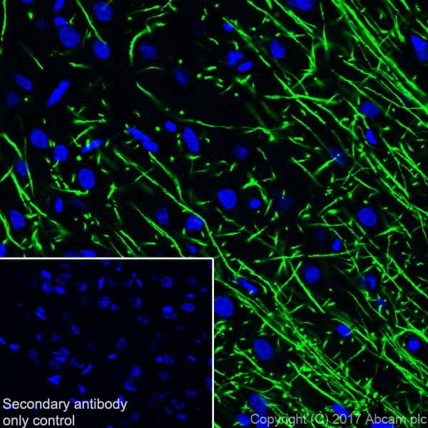 Anti-Myelin Basic Protein antibody [EPR21188](AB218011)