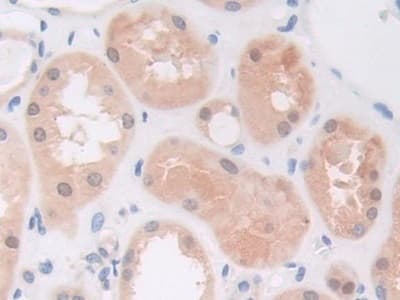 Anti-PI3 Kinase p110 beta antibody(ab232997)