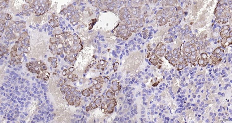 Anti-Nicotinic Acetylcholine Receptor alpha 7 antibody(AB216485)