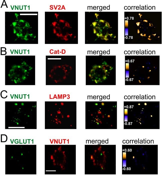 DyLight® 488 Conjugation Kit (Fast) - Lightning-Link®(AB201799)