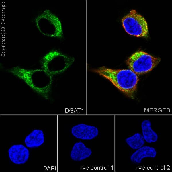 Anti-DGAT1 antibody [EPR13430](AB178711)