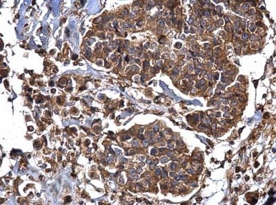 Anti-Dynamin 2 antibody(AB227192)