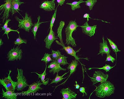 Anti-pan Cytokeratin antibody [AE1/AE3 + 5D3](AB86734)