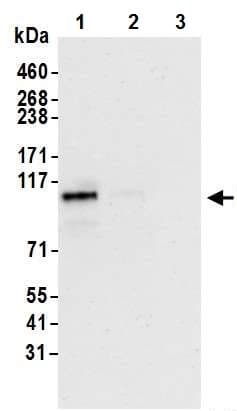 Anti-HIF-2-alpha antibody [BL-95-1A2](AB243861)