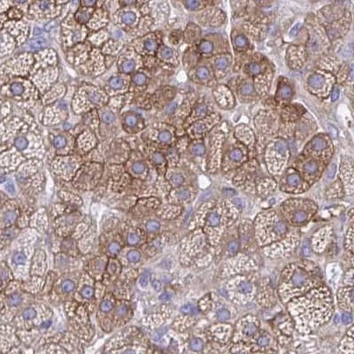 Anti-EPB41L1 antibody(AB244499)