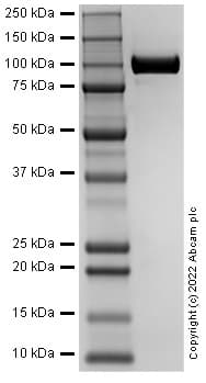 Ab302449  Sds Page Img402648