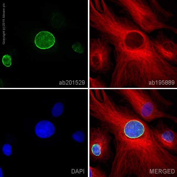 Alexa Fluor® 488 Anti-Lamin B Receptor/LBR antibody [E398L](AB201532)