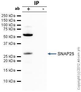 Anti-SNAP25 antibody(AB41455)