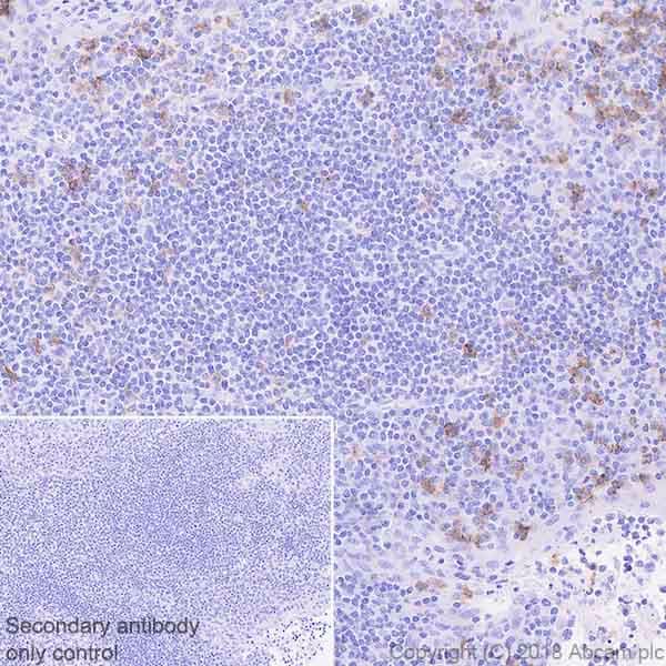Anti-FCRL4 antibody [EPR21961](ab239076)