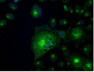 Anti-GLUT5 antibody [OTI20E1](AB279363)