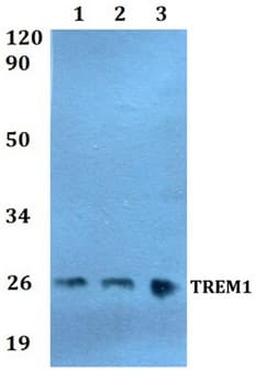 Trem1 Antibody Ab200729  Western Blot Img22263