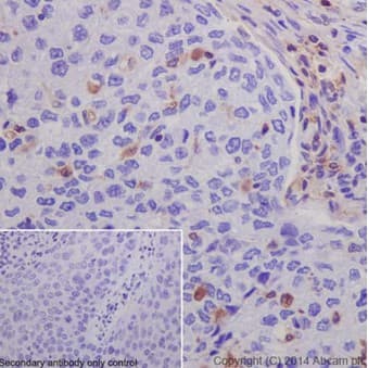 Anti-S100A4 antibody [EPR14639(2)](AB197896)