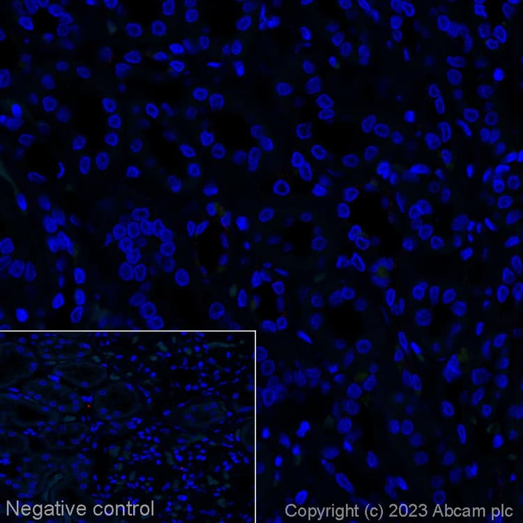 Alexa Fluor 647 Cxcl13 Antibody Epr23400 92 Ab314944  Immunohistochemistry Formalin Pfa Fixed Paraffin Embedded Sections Img423933