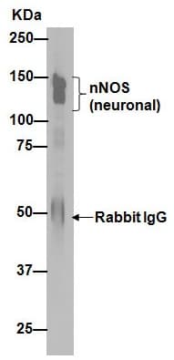 Anti-nNOS (neuronal) antibody [EP1855Y](AB76067)