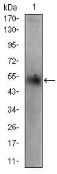 Anti Perilipin-2 antibody [2C5H8](AB181452)