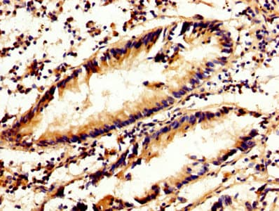 Calpain 2 Antibody Ab236650  Immunohistochemistry Formalin Pfa Fixed Paraffin Embedded Sections Img87417