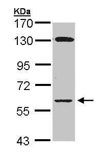 Glycerol Kinase Antibody Ab228615  Western Blot Img44017