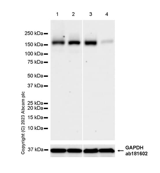 Anti-SCAP antibody [EPR26242-60](AB308060)