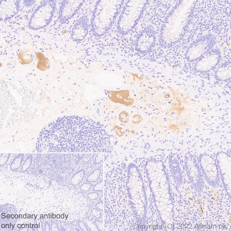 Complement Factor B Antibody Epr27443 6 Bsa And Azide Free Ab309150  Immunohistochemistry Formalin Pfa Fixed Paraffin Embedded Sections Img409465