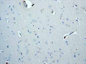 Anti-Trefoil Factor 3 antibody [EPR3974](AB108599)