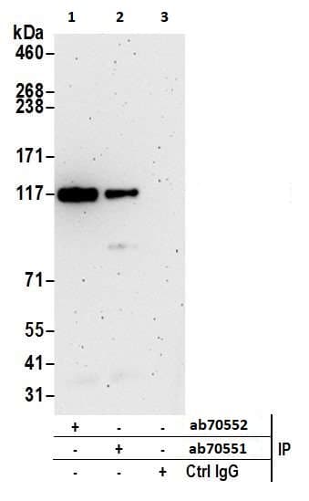 Mtr4 Antibody Ab70551  Immunoprecipitation Img123242