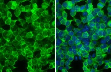 Creatine Kinase B Type Antibody Ab151579  Immunocytochemistry Immunofluorescence Img452075