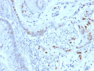Anti-Cyclin E1 antibody [CCNE1/2460](AB238081)