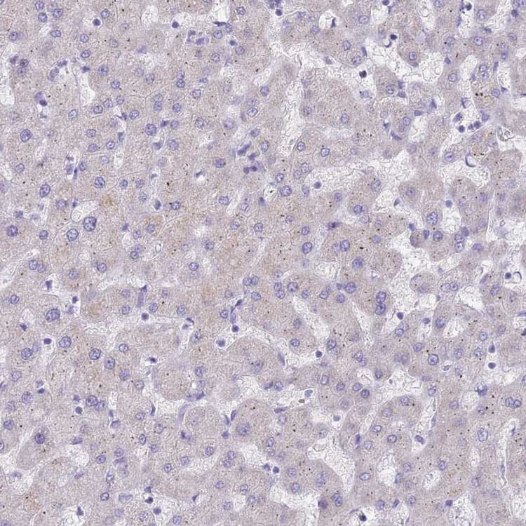 Ddhd1 Antibody Ab151078  Immunohistochemistry Formalin Pfa Fixed Paraffin Embedded Sections Img74318