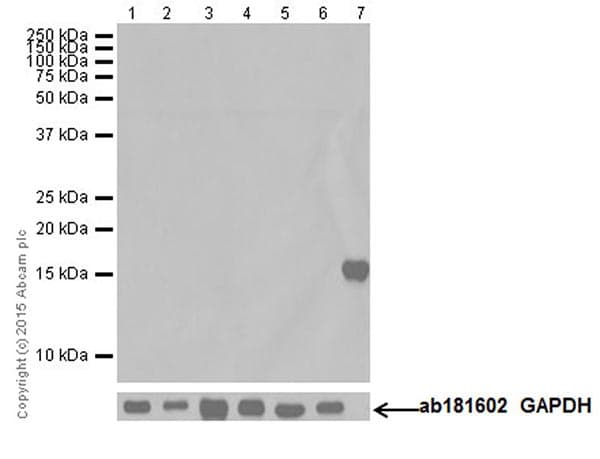 Olfactory Marker Protein Omp Antibody Epr19157 Bsa And Azide Free Ab250713  Western Blot Img9686