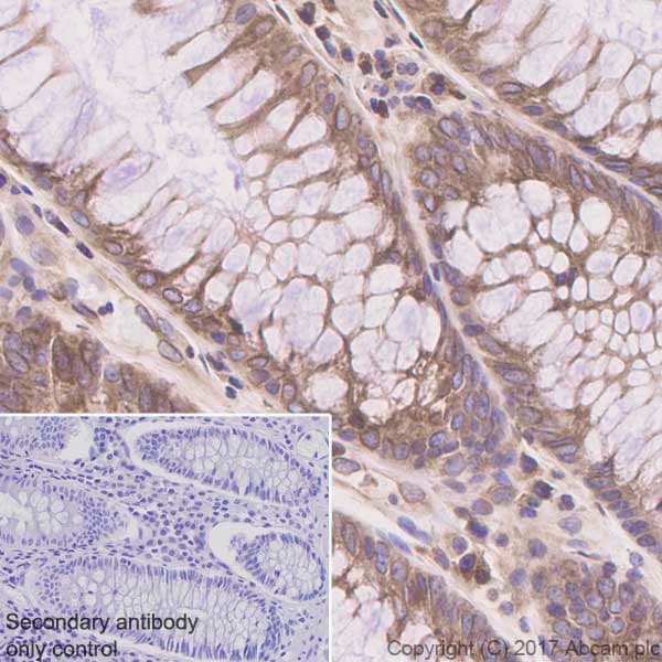 Anti-ADAM15 antibody [EPR5619](AB124698)