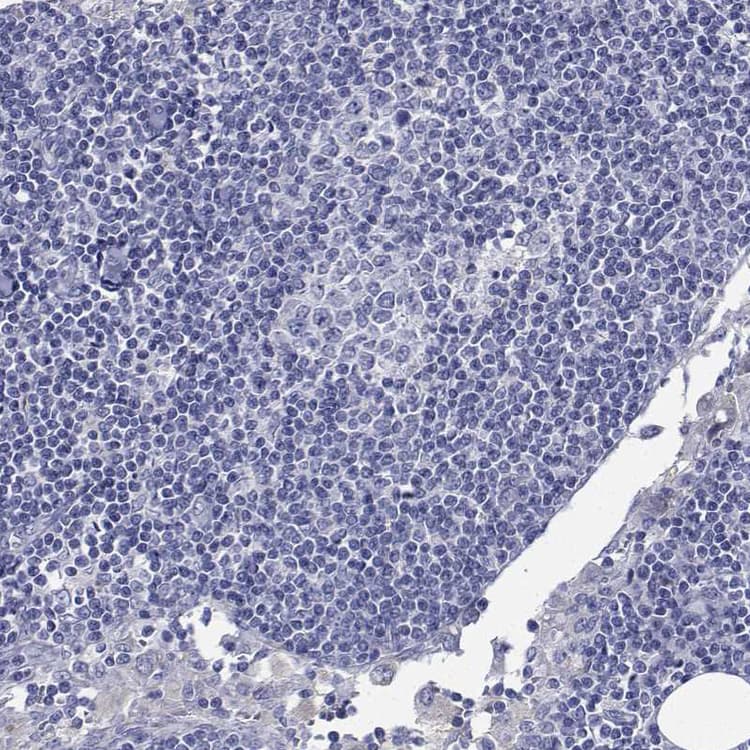 Flj23834 Antibody Ab121337  Immunohistochemistry Formalin Pfa Fixed Paraffin Embedded Sections Img127060