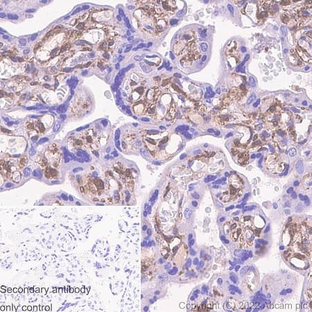 Galectin 1 Antibody Epr3205 Bsa And Azide Free Ab271876  Immunohistochemistry Formalin Pfa Fixed Paraffin Embedded Sections Img405258
