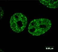 Anti-gamma H2A.X (phospho S139) antibody [3F2](AB22551)