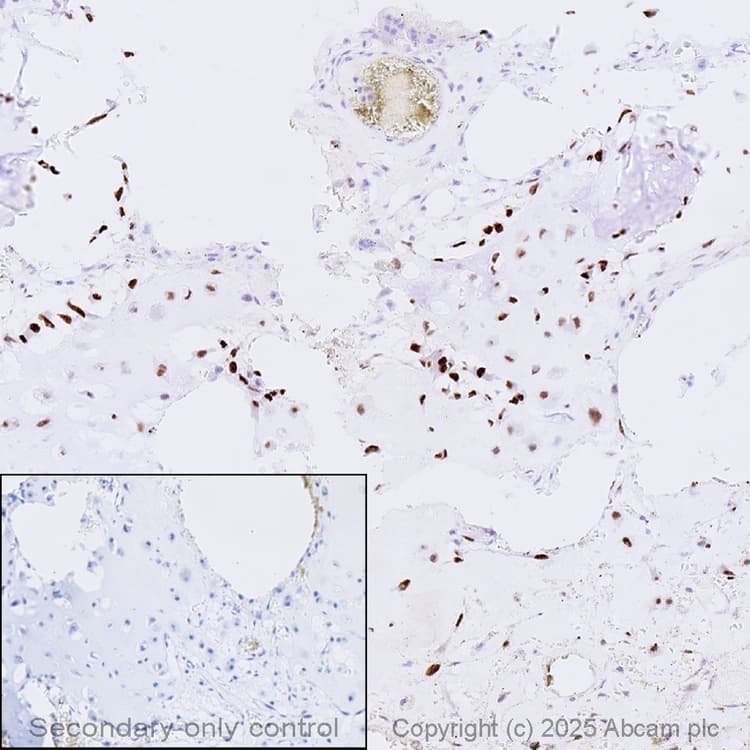 Anti-Sp7 / Osterix antibody [EPR21034] - BSA and Azide free(ab227820)