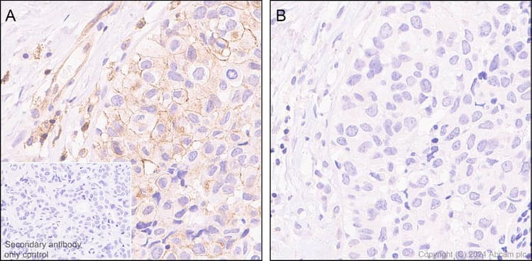 Anti-Lck (phospho Y394) antibody [EPR27974-93](AB318960)
