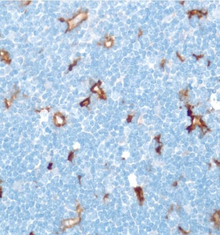 Cd16 Antibody Sp175 Ab183354  Immunohistochemistry Formalin Pfa Fixed Paraffin Embedded Sections Img115221
