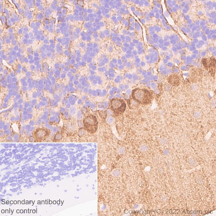 Anti-Aldolase C - C-terminal antibody [EPR26896-2] - BSA and Azide free(AB307413)
