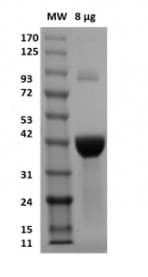 Recombinant L-methionine gamma-lyase Active protein (mutated F47L + D172E + S308Y)(ab286034)
