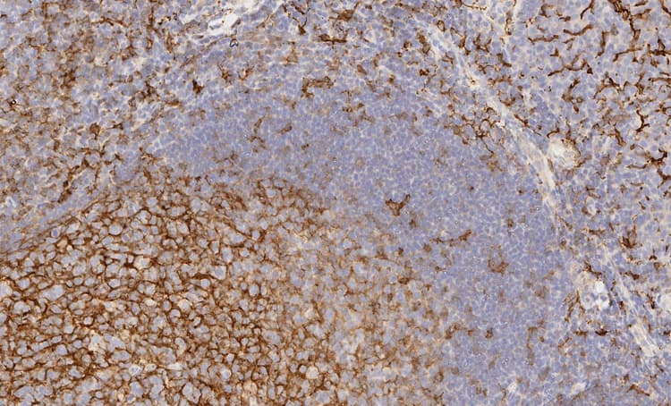 Anti-CD14 antibody [EPR3653] - BSA and Azide free(AB226121)