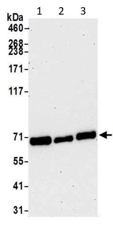 Anti-CARM1 antibody(AB245467)