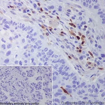 Anti-S100A4 antibody [EPR14639(2)](AB197896)