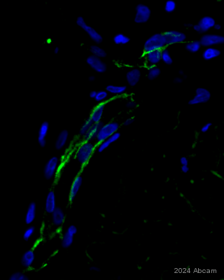 Anti-CD31 antibody [RM1006](AB281583)