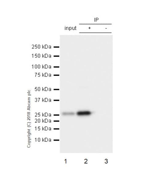Anti-HPRT antibody [EPR5299](AB109021)