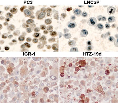 Anti-AKT1 (phospho S473) antibody(ab8932)