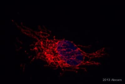 Anti-Pyruvate dehydrogenase E2/E3bp antibody [13G2AE2BH5](AB110333)
