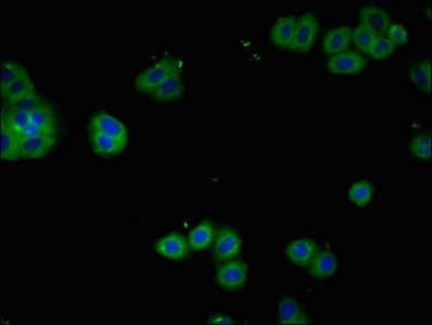 Anti-IL-2 Receptor alpha antibody(AB235906)