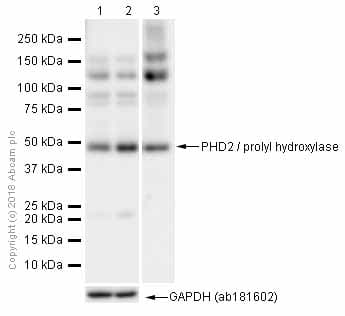 Anti-PHD2 / prolyl hydroxylase antibody [EPR3660(B)(2)](AB133630)