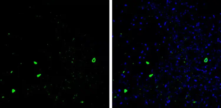 Anti-Parvalbumin antibody(AB256811)
